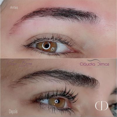 Renew Brows